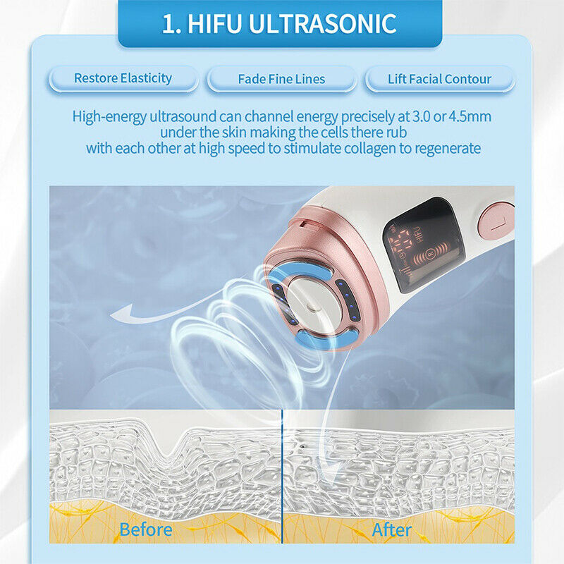 ultradźwięki hifu